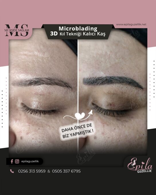 Nazilli - Microblading 3D Kıl Tekniği Kalıcı Kaş Kontürü