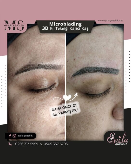 Nazilli - Microblading 3D Kıl Tekniği Kalıcı Kaş Kontürü