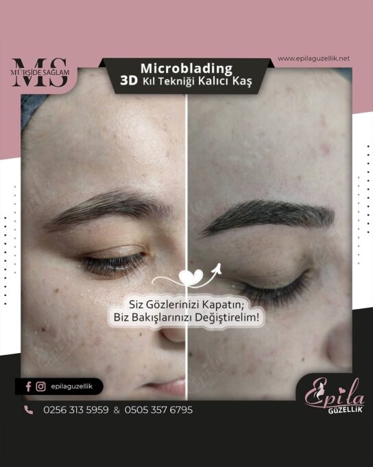 Nazilli - Microblading 3D Kıl Tekniği Kalıcı Kaş Kontürü