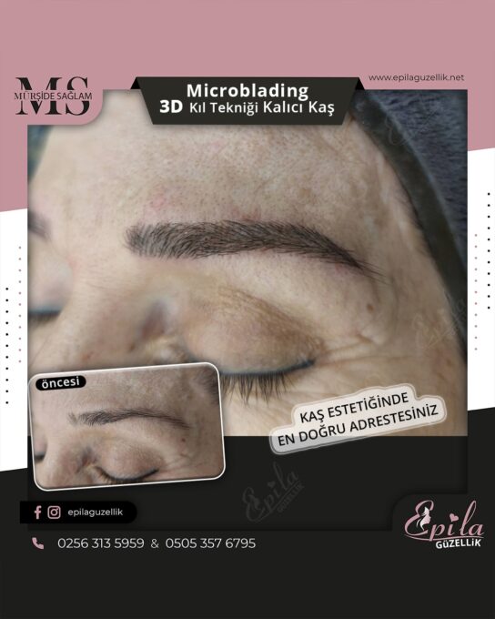 Nazilli - Microblading 3D Kıl Tekniği Kalıcı Kaş Kontürü