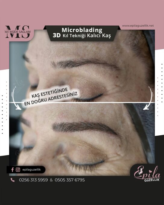 Nazilli - Microblading 3D Kıl Tekniği Kalıcı Kaş Kontürü