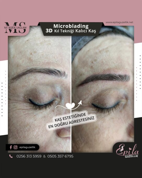 Nazilli - Microblading 3D Kıl Tekniği Kalıcı Kaş Kontürü