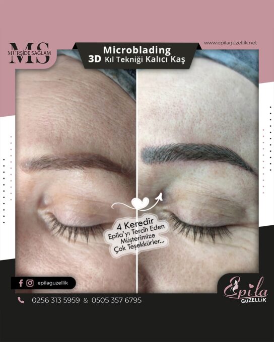 Nazilli - Microblading 3D Kıl Tekniği Kalıcı Kaş Kontürü