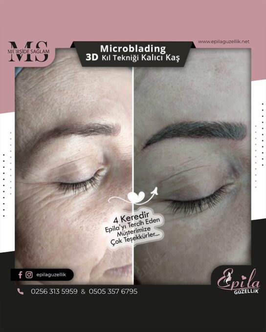 Nazilli - Microblading 3D Kıl Tekniği Kalıcı Kaş Kontürü