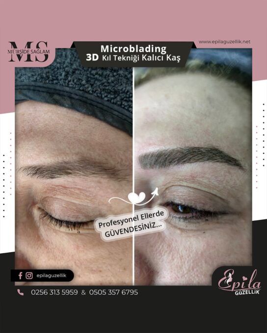 Nazilli - Microblading 3D Kıl Tekniği Kalıcı Kaş Kontürü