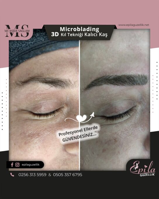 Nazilli - Microblading 3D Kıl Tekniği Kalıcı Kaş Kontürü