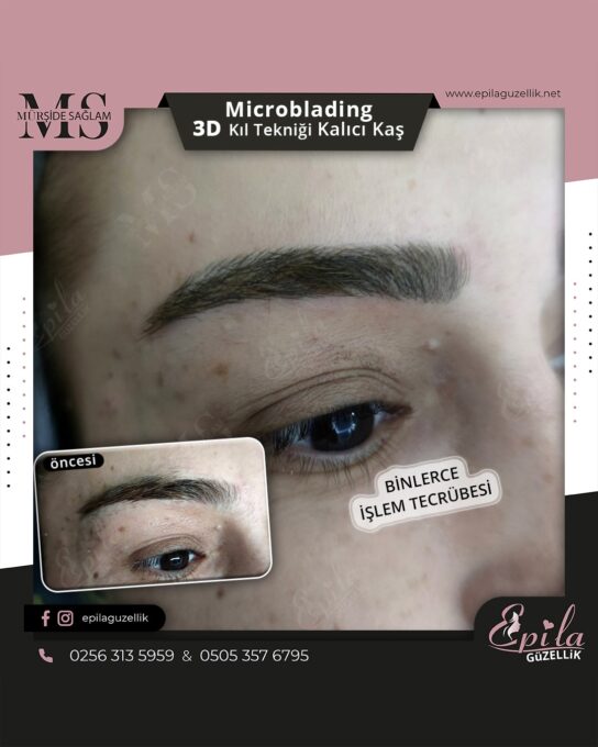 Nazilli - Microblading 3D Kıl Tekniği Kalıcı Kaş Kontürü