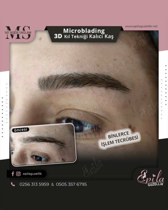 Nazilli - Microblading 3D Kıl Tekniği Kalıcı Kaş Kontürü