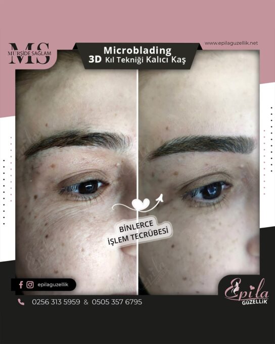 Nazilli - Microblading 3D Kıl Tekniği Kalıcı Kaş Kontürü