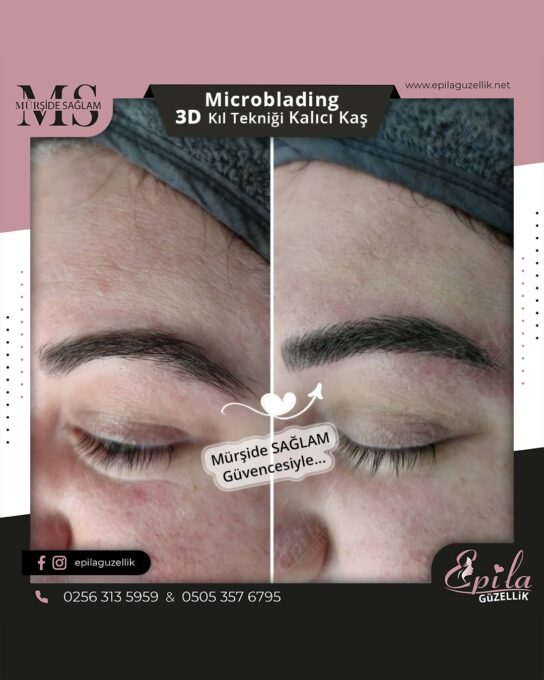 Nazilli - Microblading 3D Kıl Tekniği Kalıcı Kaş Kontürü