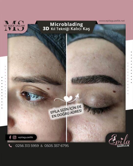 Nazilli - Microblading 3D Kıl Tekniği Kalıcı Kaş Kontürü