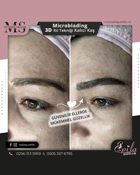 Nazilli - Microblading 3D Kıl Tekniği Kalıcı Kaş Kontürü