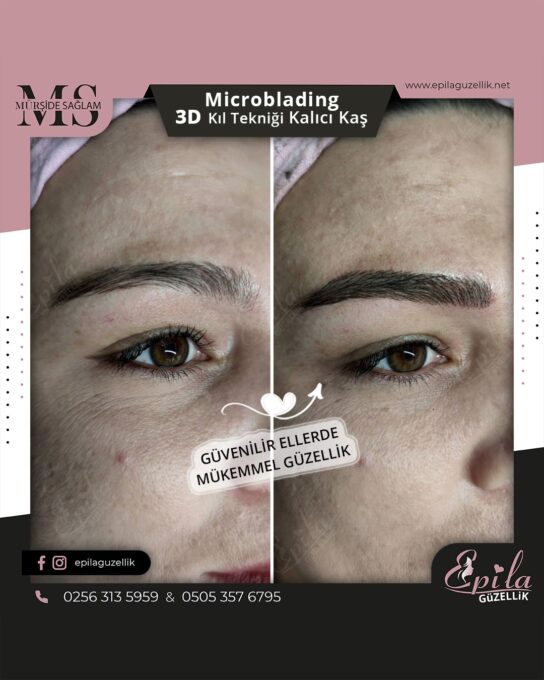 Nazilli - Microblading 3D Kıl Tekniği Kalıcı Kaş Kontürü