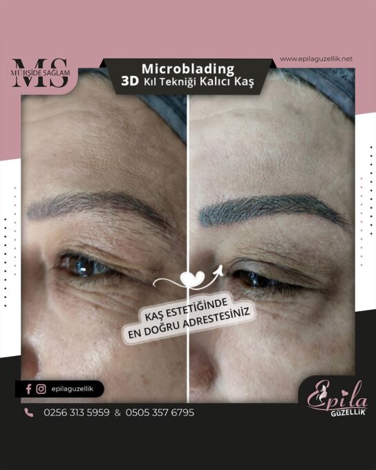 Nazilli - Microblading 3D Kıl Tekniği Kalıcı Kaş Kontürü