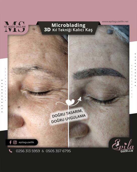 Nazilli - Microblading 3D Kıl Tekniği Kalıcı Kaş Kontürü