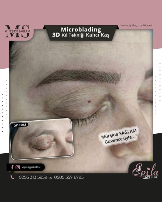 Nazilli - Microblading 3D Kıl Tekniği Kalıcı Kaş Kontürü