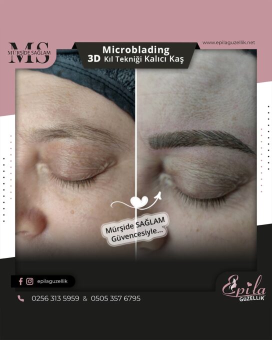 Nazilli - Microblading 3D Kıl Tekniği Kalıcı Kaş Kontürü