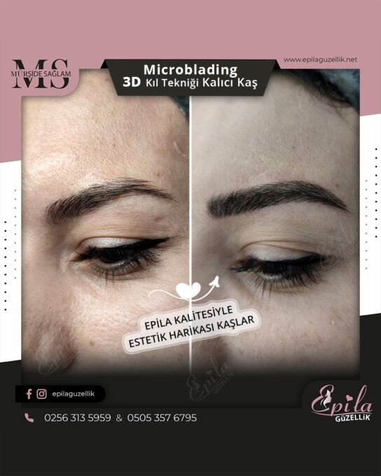 Nazilli - Microblading 3D Kıl Tekniği Kalıcı Kaş Kontürü