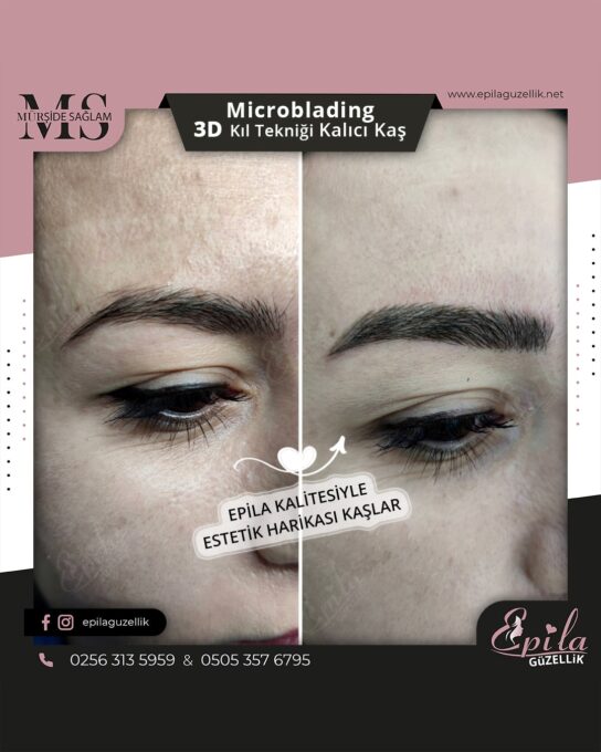 Nazilli - Microblading 3D Kıl Tekniği Kalıcı Kaş Kontürü