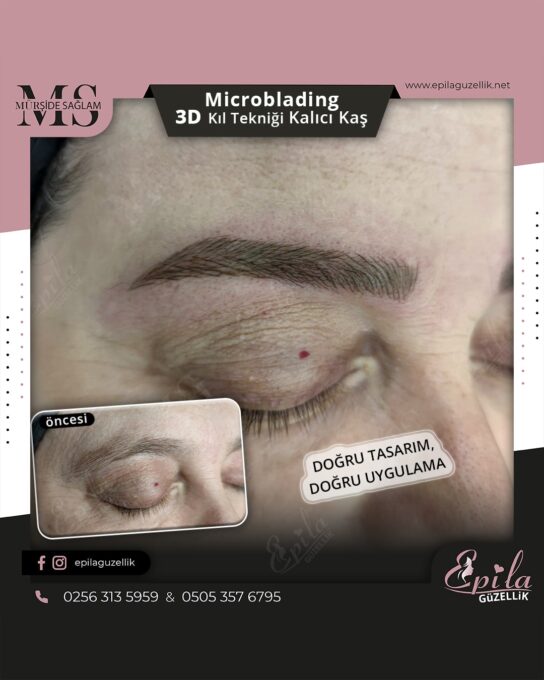 Nazilli - Microblading 3D Kıl Tekniği Kalıcı Kaş Kontürü