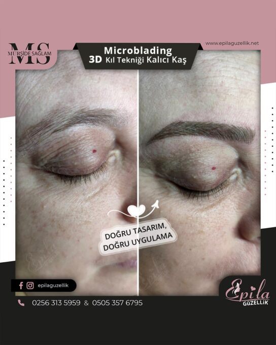 Nazilli - Microblading 3D Kıl Tekniği Kalıcı Kaş Kontürü