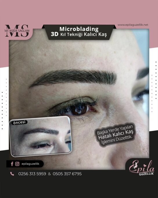 Nazilli - Microblading 3D Kıl Tekniği Kalıcı Kaş Kontürü