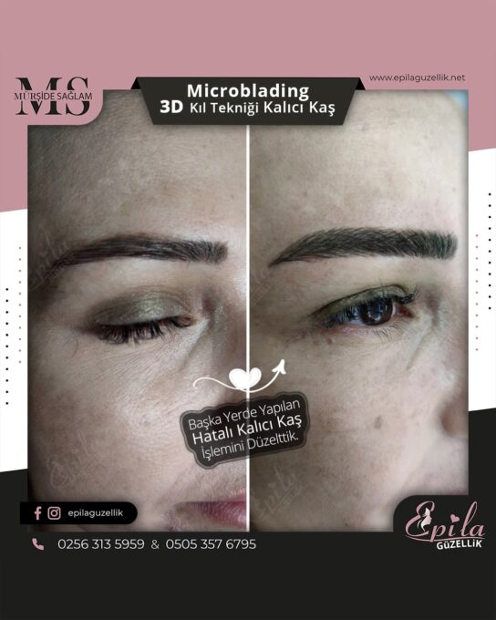 Nazilli - Microblading 3D Kıl Tekniği Kalıcı Kaş Kontürü