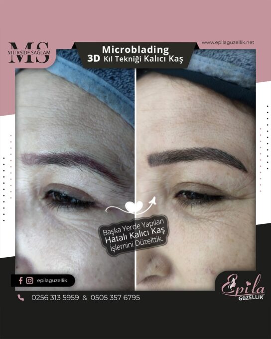 Nazilli - Microblading 3D Kıl Tekniği Kalıcı Kaş Kontürü