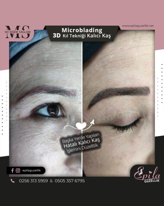 Nazilli - Microblading 3D Kıl Tekniği Kalıcı Kaş Kontürü