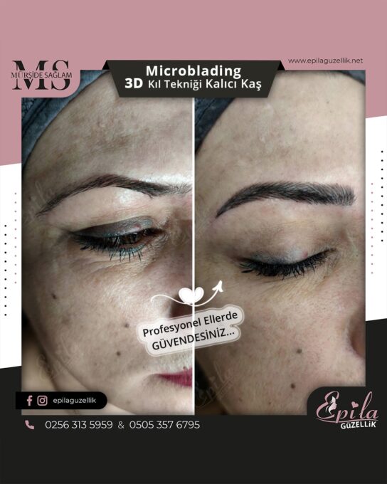 Nazilli - Microblading 3D Kıl Tekniği Kalıcı Kaş Kontürü