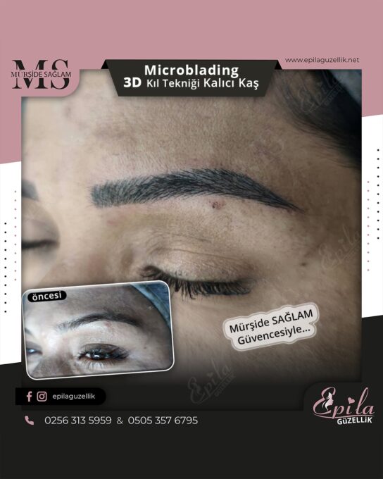 Nazilli - Microblading 3D Kıl Tekniği Kalıcı Kaş Kontürü