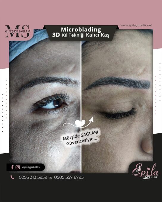 Nazilli - Microblading 3D Kıl Tekniği Kalıcı Kaş Kontürü