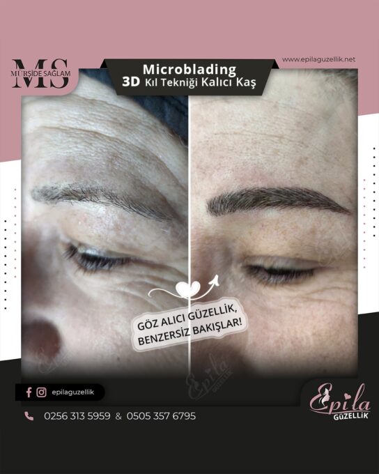 Nazilli - Microblading 3D Kıl Tekniği Kalıcı Kaş Kontürü