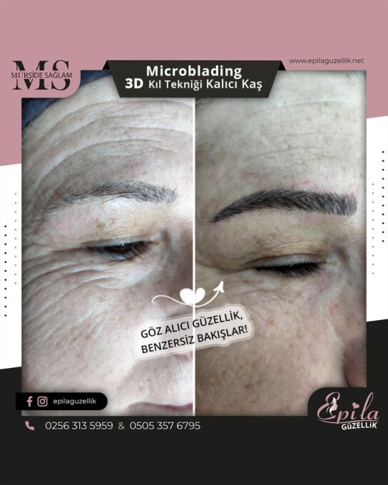 Nazilli - Microblading 3D Kıl Tekniği Kalıcı Kaş Kontürü