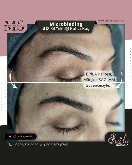 Nazilli - Microblading 3D Kıl Tekniği Kalıcı Kaş Kontürü