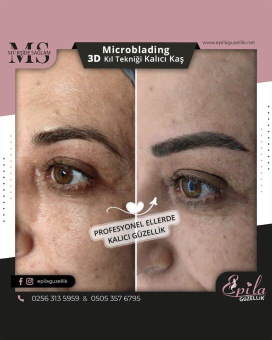 Nazilli - Microblading 3D Kıl Tekniği Kalıcı Kaş Kontürü