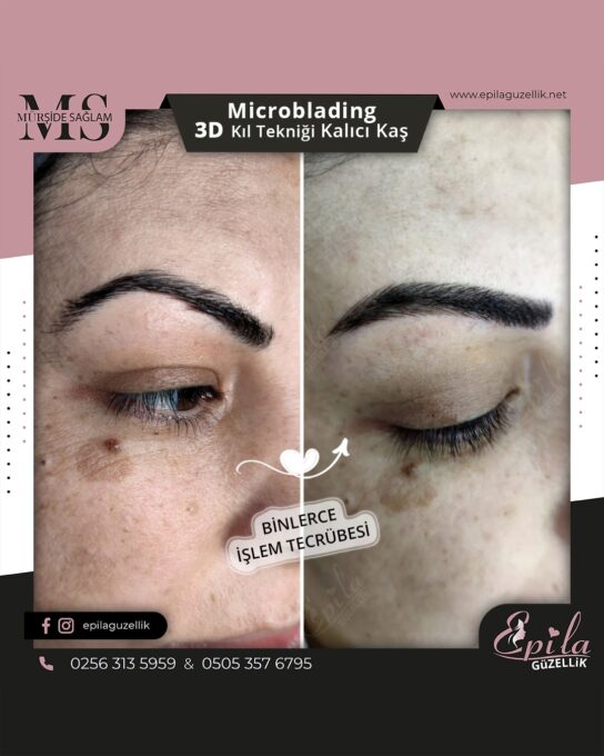 Nazilli - Microblading 3D Kıl Tekniği Kalıcı Kaş Kontürü