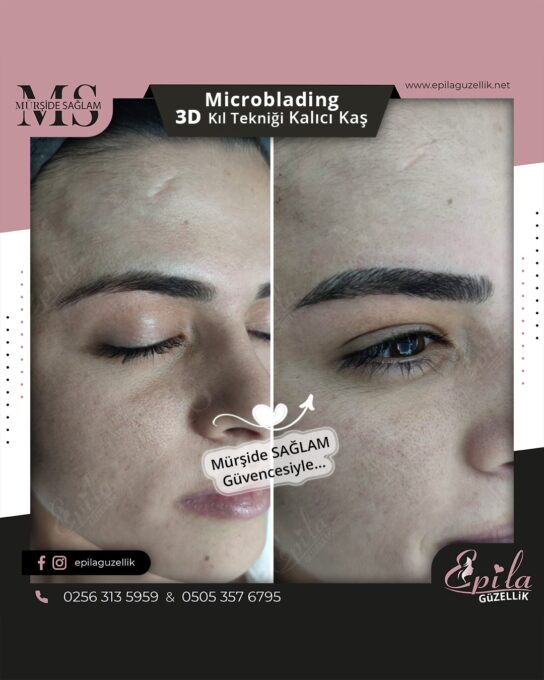 Nazilli - Microblading 3D Kıl Tekniği Kalıcı Kaş Kontürü