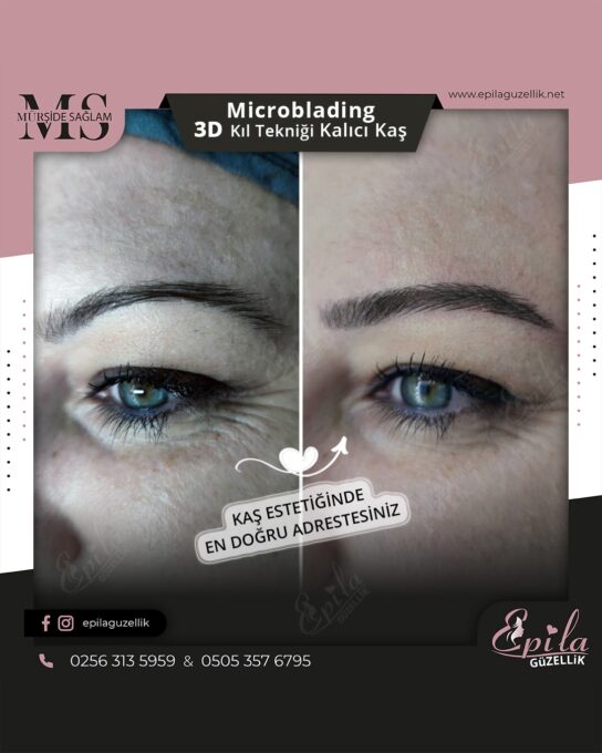 Nazilli - Microblading 3D Kıl Tekniği Kalıcı Kaş Kontürü