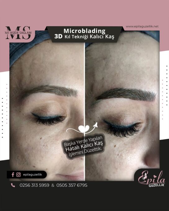 Nazilli - Microblading 3D Kıl Tekniği Kalıcı Kaş Kontürü