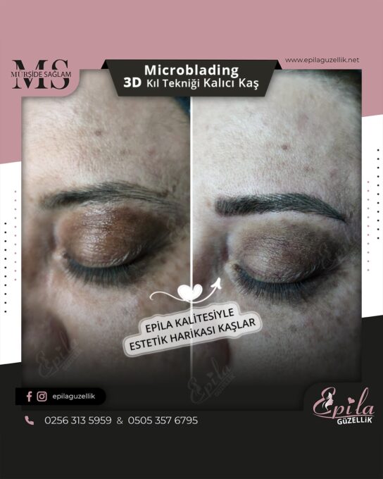 Nazilli - Microblading 3D Kıl Tekniği Kalıcı Kaş Kontürü