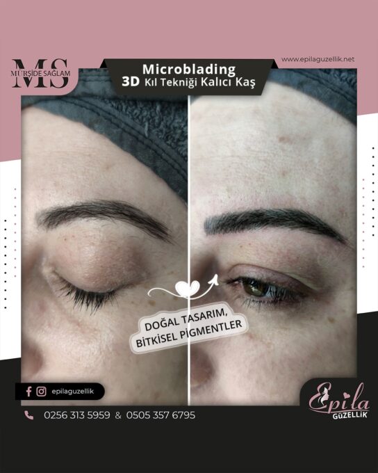 Nazilli - Microblading 3D Kıl Tekniği Kalıcı Kaş Kontürü