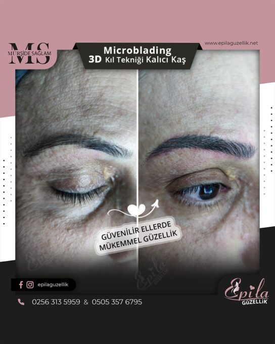 Nazilli - Microblading 3D Kıl Tekniği Kalıcı Kaş Kontürü