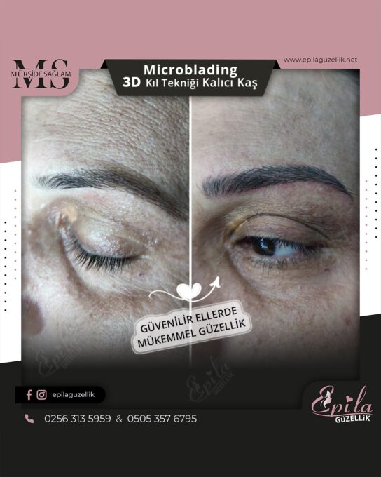 Nazilli - Microblading 3D Kıl Tekniği Kalıcı Kaş Kontürü