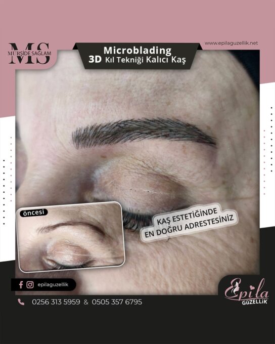 Nazilli - Microblading 3D Kıl Tekniği Kalıcı Kaş Kontürü