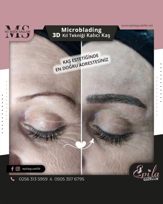 Nazilli - Microblading 3D Kıl Tekniği Kalıcı Kaş Kontürü