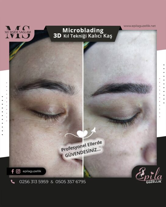 Nazilli - Microblading 3D Kıl Tekniği Kalıcı Kaş Kontürü