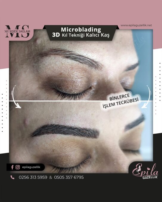 Nazilli - Microblading 3D Kıl Tekniği Kalıcı Kaş Kontürü