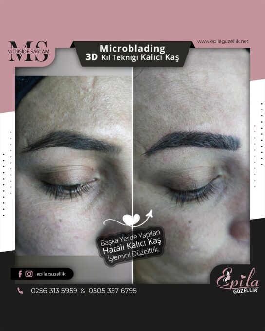 Nazilli - Microblading 3D Kıl Tekniği Kalıcı Kaş Kontürü