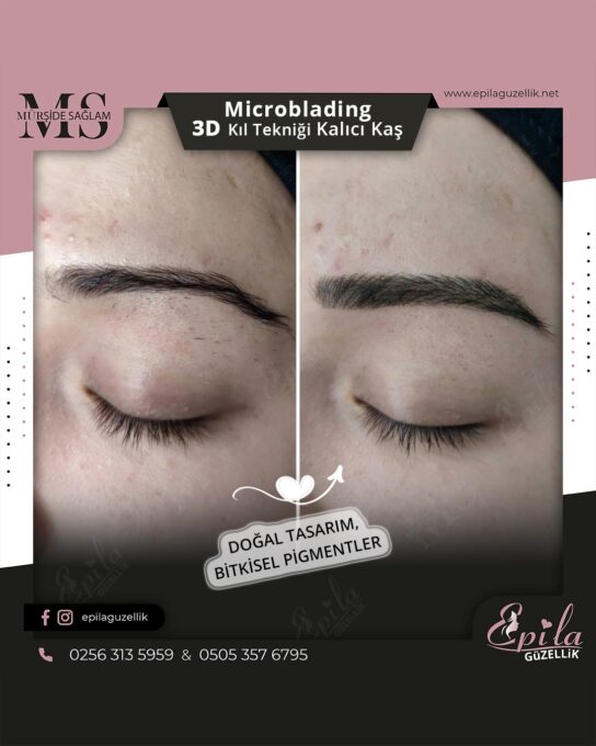 Nazilli - Microblading 3D Kıl Tekniği Kalıcı Kaş Kontürü